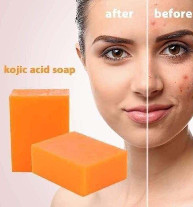 Kojie San Skin Lightening Soap