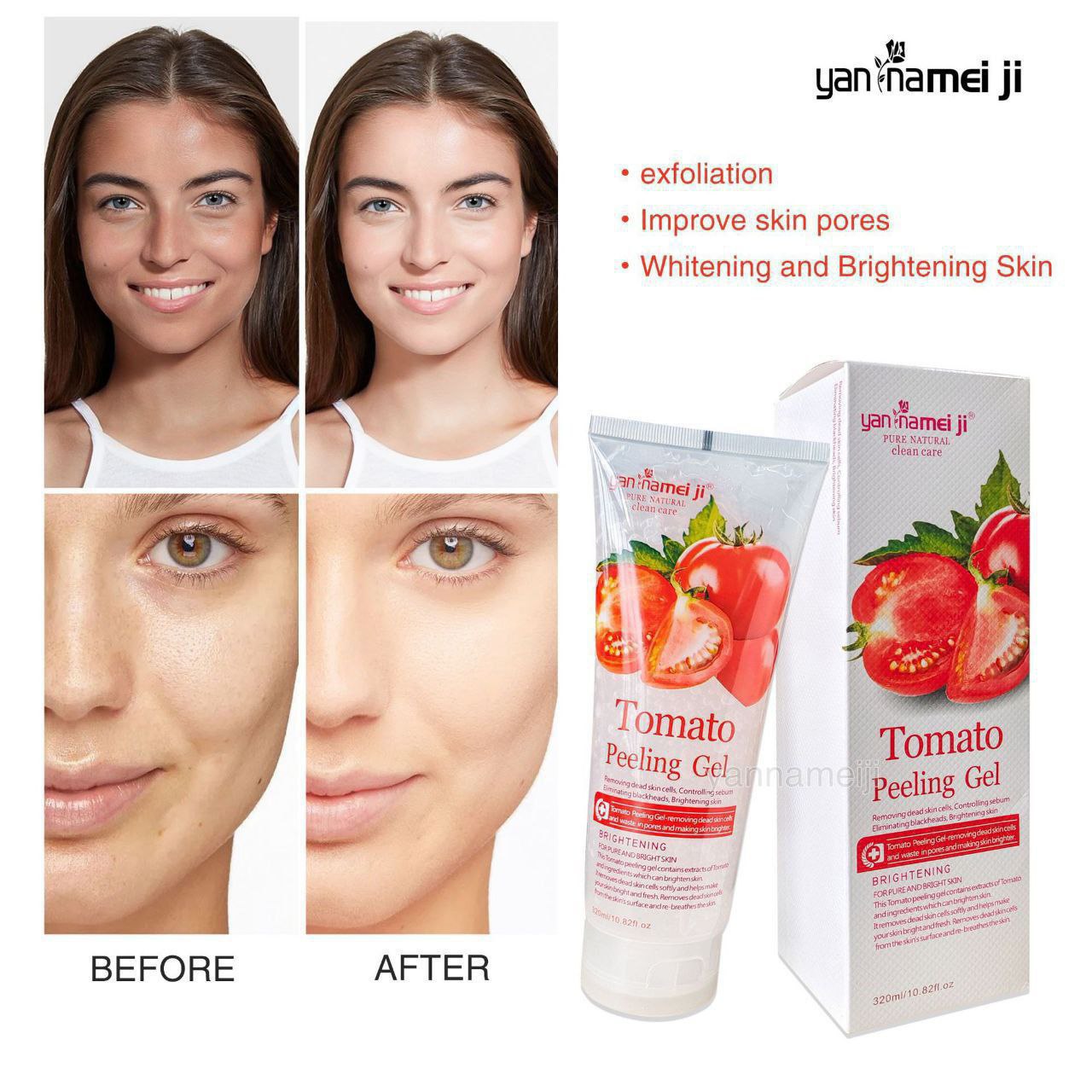 Peeling Gel