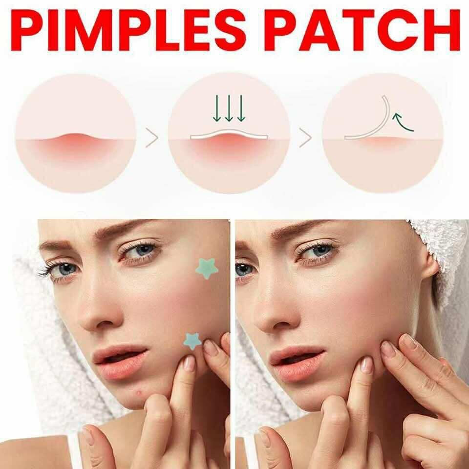 Pimple Patch Sticker
